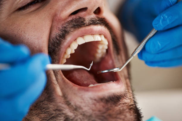 Best Emergency Dental Care for Broken or Chipped Teeth in Port Carbon, PA